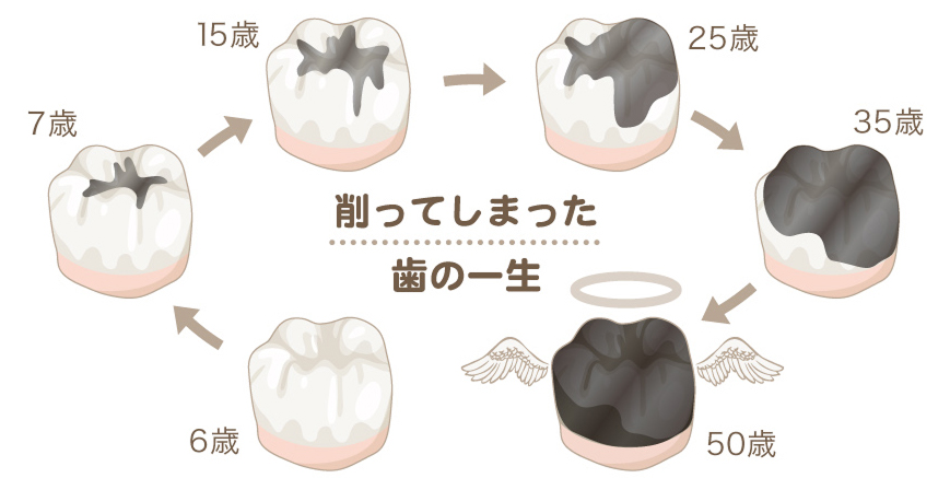 生涯むし歯なしで過ごすには6歳が最重要