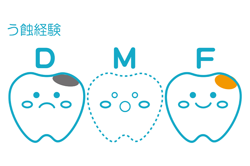 むし歯のリスクチェック