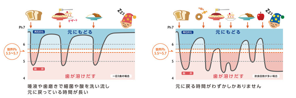 むし歯のリスクチェック