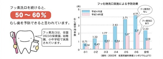 フッ化物洗口の効果は？